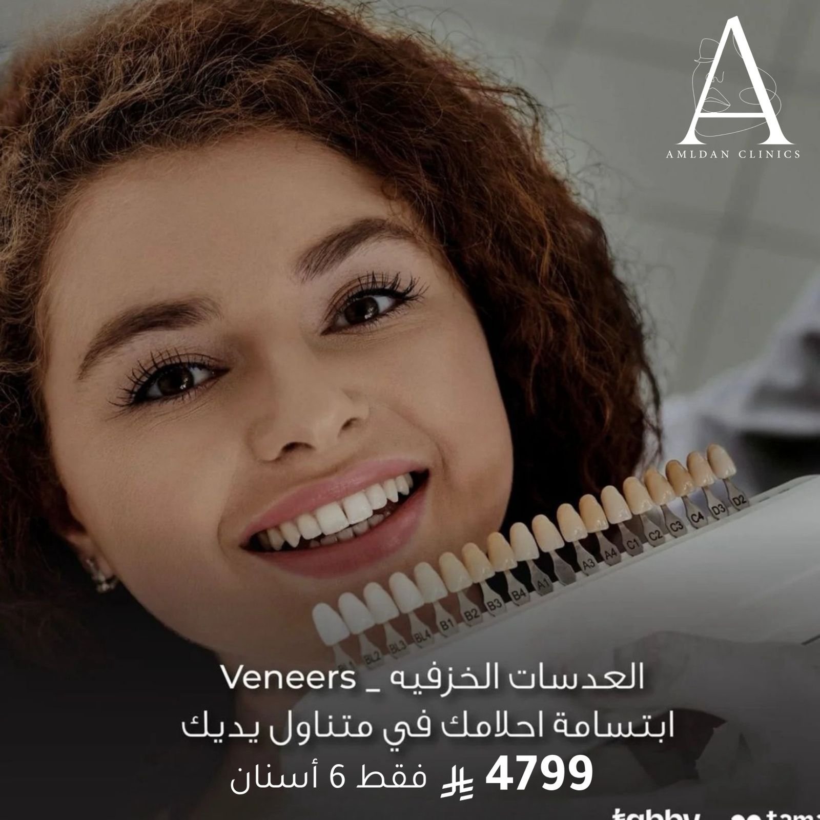 ابتسامة هوليوود فقط ب 4799