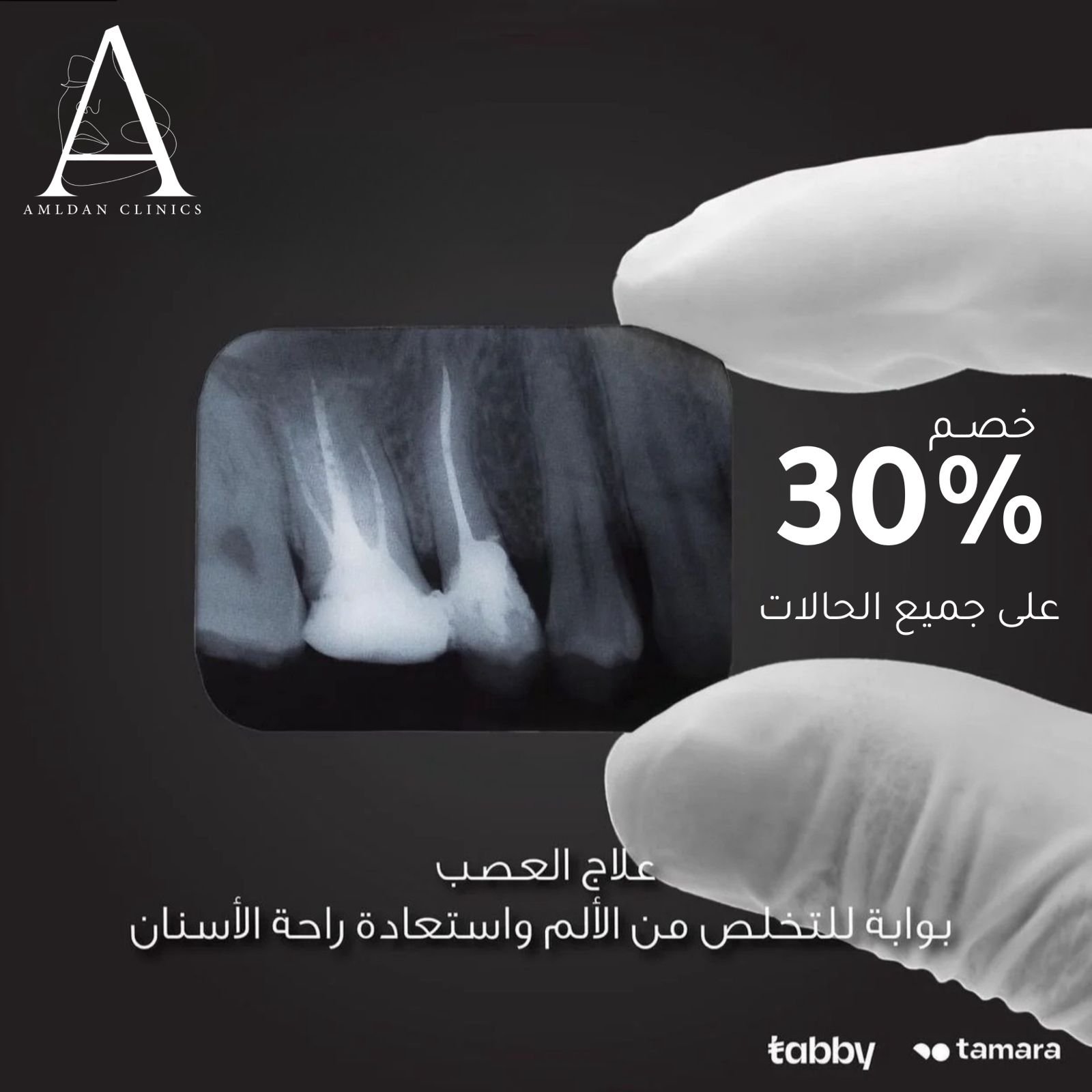 تخلص من الألم واستعد راحة الأسنان بجلسه واحدة وبدون ألم  وبخصم 20% على جميع علاجات العصب