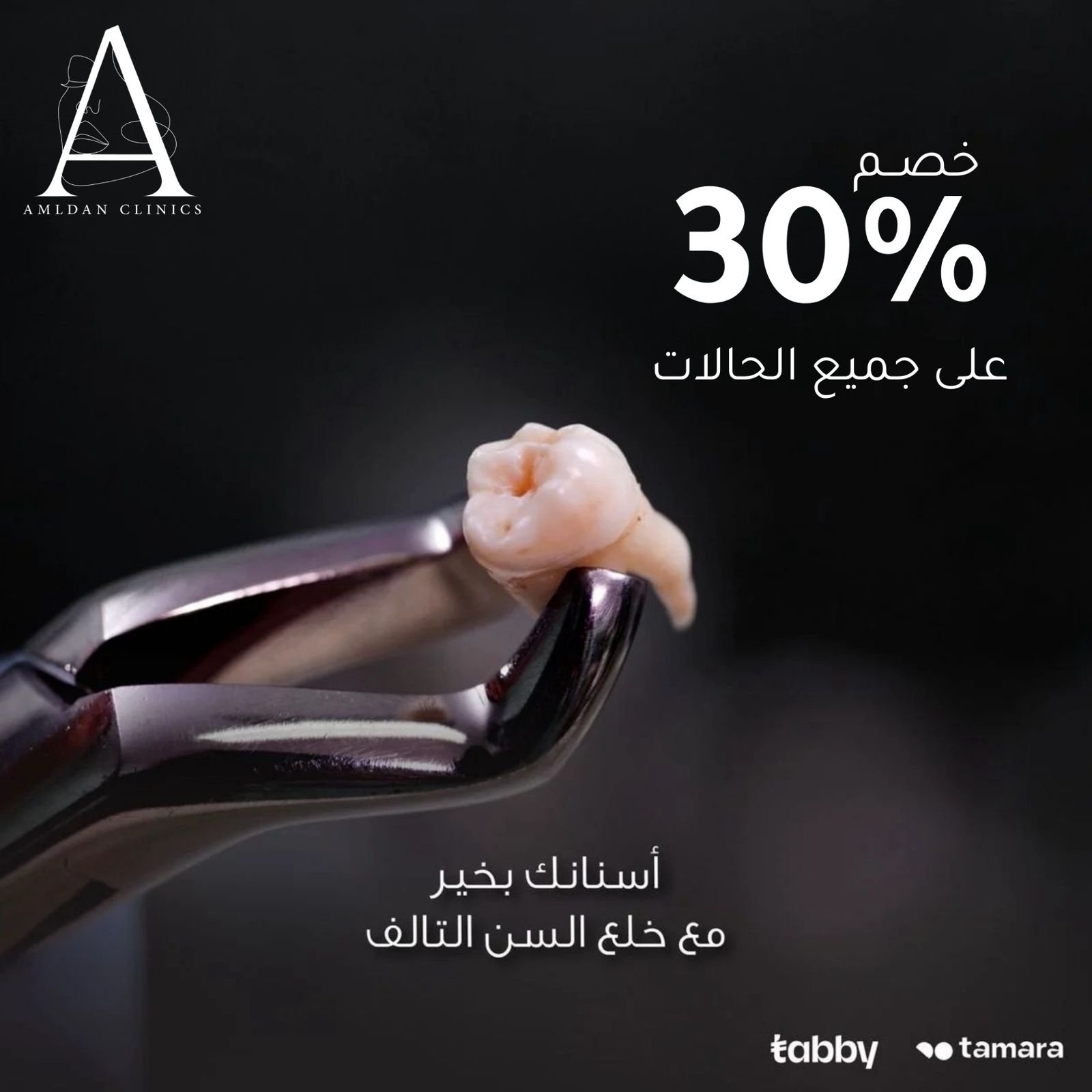 خصم 30 % على جميع حالات خلع الأسنان
